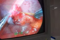 Nguy hại khó lường do thói quen "ngậm tăm" của hàng triệu người Việt