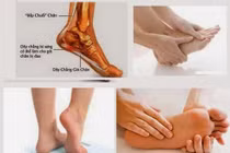 Bệnh nơi bàn chân và cách gìn giữ để khỏe