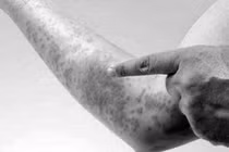 Uống thuốc bổ chuốc thêm bệnh