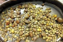 Nhiều phương pháp tán sỏi ngoài cơ thể không đau đớn