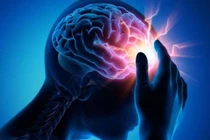 Rối loạn tuần hoàn não có nguy hiểm không?