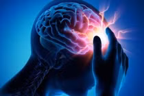 Rối loạn tuần hoàn não có nguy hiểm không?