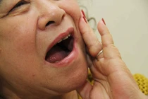 Kích thích huyệt thận trị đau răng