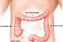 Nội soi tiêu hóa dưới ánh sáng NBI 
