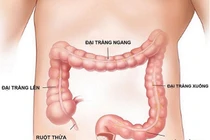 Nội soi tiêu hóa dưới ánh sáng NBI 