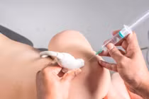 Tiêm nong “giải” đông cứng khớp vai