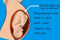 Thiểu ối thai kỳ