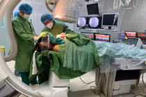 Tạo nhịp tim từ bó his trái điều trị bệnh nhân rối loạn nhịp tim