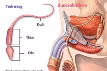 Vô tinh trùng do vi đứt đoạn NST Y