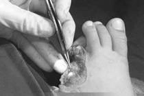 Lưỡi gió thời trang phang đứt chân trẻ