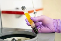 Kháng thể siêu mạnh trong huyết tương người khỏi bệnh Covid-19