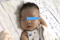 Trẻ bị viêm rò mủ hàm trên vì không được làm sạch răng miệng 