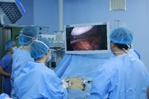 Biến chứng trong phẫu thuật nội soi khi gây mê 