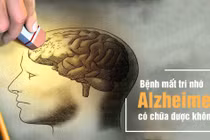 3 nhóm yếu tố nguy cơ gây bệnh alzheimer