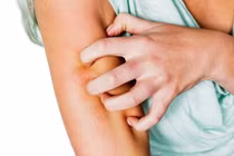 Chà sát nhẹ là ngứa