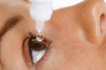 Cách nhỏ thuốc mắt hiệu quả