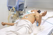 Uốn ván vì chủ quan với vết xước nhỏ