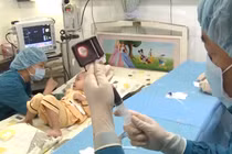 Bệnh nhi mắc bệnh về máu được ghép tế bào gốc tại Bệnh viện Truyền máu - Huyết học TPHCM 