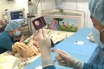 Bệnh nhi mắc bệnh về máu được ghép tế bào gốc tại Bệnh viện Truyền máu - Huyết học TPHCM 