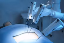 Phẫu thuật bằng robot hiệu quả cao đối với bệnh nhân bị ung thư bàng quang