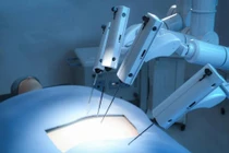 Phẫu thuật bằng robot hiệu quả cao đối với bệnh nhân bị ung thư bàng quang