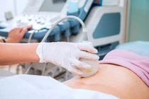 Có nên siêu âm trước khi mang thai?