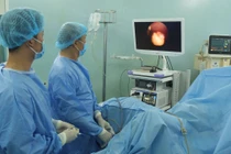 Tán vỡ sỏi to trong bàng quang tân tạo bằng laser