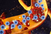 Hoại tử xương: Nguyên nhân và cách điều trị