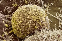 Nhờ phương pháp cấy ghép liên quan đến Bệnh nhân HIV thứ 3 được chữa khỏi nhờ cấy ghép máu dây rốn.