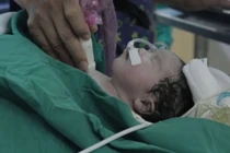 TPHCM: Cứu sống bé gái hơn 1 tuần tuổi bị bệnh tim nguy hiểm