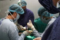 Nút mạch trong điều trị u xơ tuyến tiền liệt