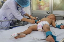 Bệnh nhân tay chân miệng tăng gấp 2,5 lần