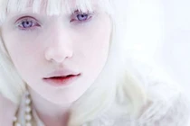 Nghị lực của cô gái bạch tạng với ước mơ trở thành người mẫu