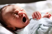 Trẻ sinh non mắc hội chứng Patau