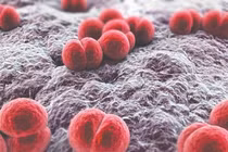 Hai trẻ nhập viện do nhiễm não mô cầu, 1 tử vong, 1 phải cắt chi