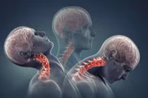 Xử trí ban đầu với chấn thương cột sống cổ