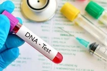 Mẫu xét nghiệm ADN chính xác