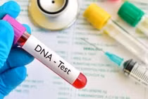 Mẫu xét nghiệm ADN chính xác