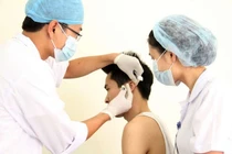 Vi cấy ghép vào huyệt đạo (cấy chỉ): Cuộc cách mạng trong châm cứu