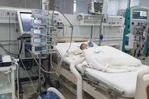 Siêu lọc máu liên tục cứu trẻ nguy kịch do biến chứng tay chân miệng
