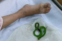 Nằm đất trời nắng cẩn thận rắn cắn