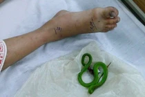 Nằm đất trời nắng cẩn thận rắn cắn