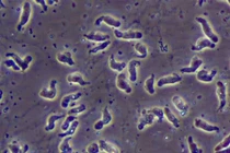 Đại tiện ra máu do lỵ amip dễ thủng ruột