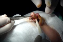 Suýt đứt lìa trụ mũi vì thẩm mỹ “dạo”