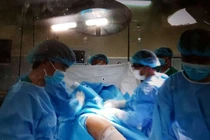 Cơ hội thay khớp háng miễn phí tại BV Quân Y 175