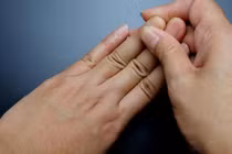 Sưng khớp nhỏ bàn tay