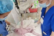 Không chủ quan với u bạch huyết ở trẻ sơ sinh