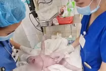 Không chủ quan với u bạch huyết ở trẻ sơ sinh