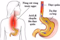  Đau lâm râm từ bụng có phải trào ngược?
