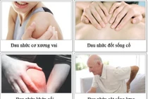  Kỹ thuật đặc biệt khống chế đau nhức xương khớp